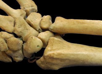 Stronger Bones Stronger Health