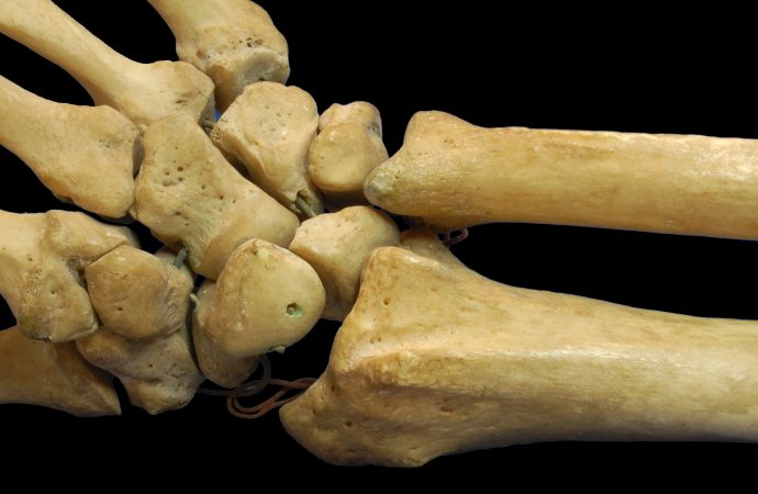 Stronger Bones Stronger Health